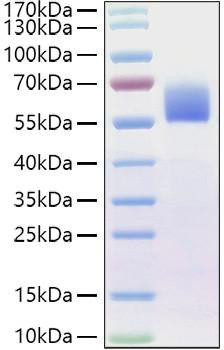 Recombinant Human BMPR-2 Protein (RPCB1172)