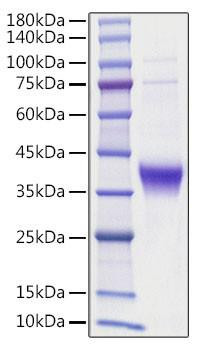 Recombinant human Ephrin-A3/EFNA3 Protein (RPCB1185)