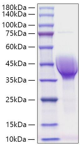 Recombinant Human CER1/DAND4 Protein (RPCB1189)