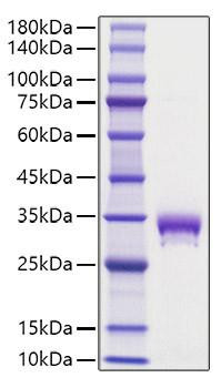 Recombinant Mouse EPO-R/Epor Protein (RPCB1235)