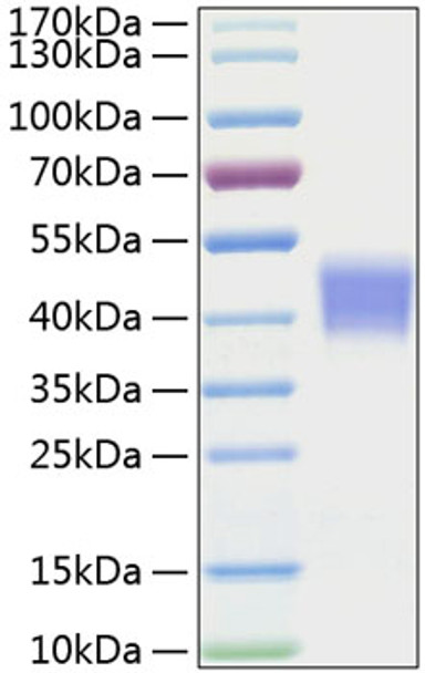 Recombinant Mouse IL-21R/CD360 Protein (RPCB1255)