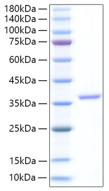Recombinant Human EREG Protein (RPCB1256)
