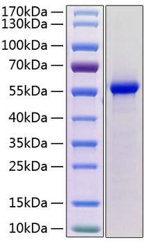 Recombinant Mouse Renin-1/REN1 Protein (RPCB1260)