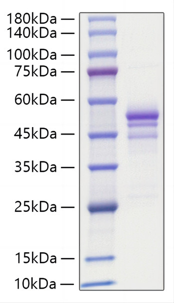 Recombinant Human Gastrin-releasing peptide/GRP Protein (RPCB1281)
