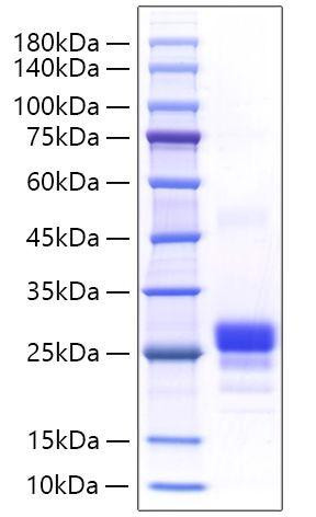 Recombinant Mouse TNFSF7/CD27 Ligand/CD70 Ligand Protein (RPCB1288)