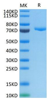 Recombinant Human Nectin-4/PVRL4 Protein (RPCB1365)