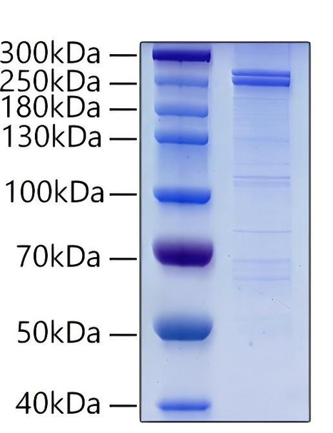 Recombinant Human DNMT1 Protein (RPCB1375)