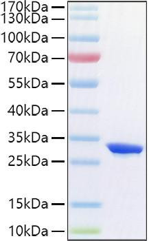 Recombinant Human Complement factor D/CFD Protein (RPCB1380)