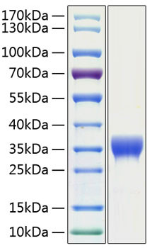 Recombinant Human SLAMF8/CD353 Protein (RPCB1421)