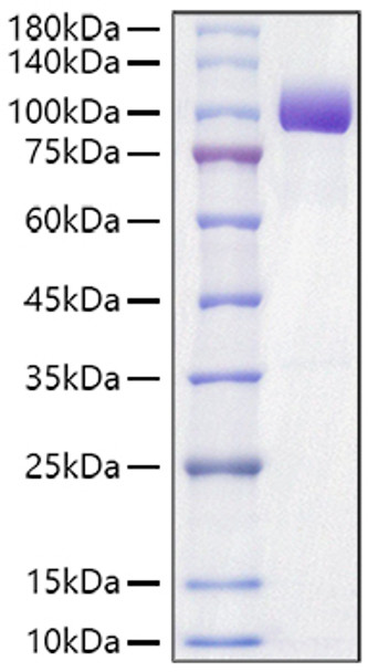Recombinant Mouse Tyrosine-protein kinase receptor UFO/Axl Protein (RPCB1449)