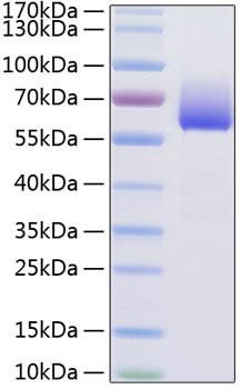 Recombinant Mouse TIM-3/HAVCR2/CD366 Protein (RPCB1502)