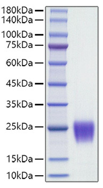 Recombinant Human Follicle Stimulating Hormone (FSH) (CGA&FSHB) Protein (RPCB1518)