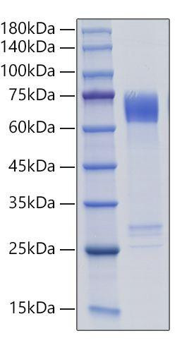 Recombinant Human MMP-8 Protein (RPCB1565)