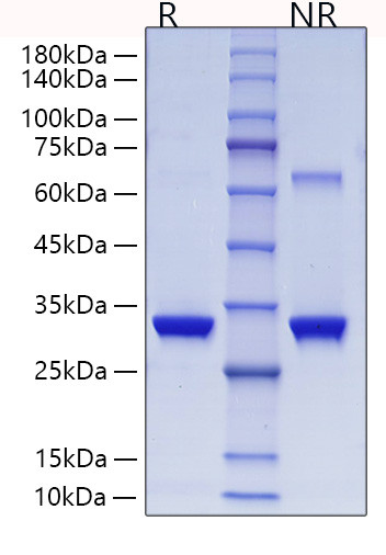 Recombinant Human Glutathione S-transferase omega-1/GSTO-1/SPG-R Protein (RPCB1572)