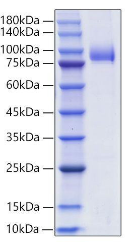 Recombinant Human Siglec-6/CD327 Protein (RPCB1591)