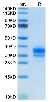 Recombinant Human FR-beta/FOLR2 Protein (RPCB1605)