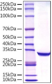 Recombinant Human PSA/KLK3 Protein (RPCB1610)