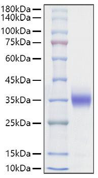 Recombinant Rat Sclerostin/SOST Protein (RPCB1624)