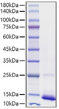 Recombinant human CD9 Protein (RPCB1648)