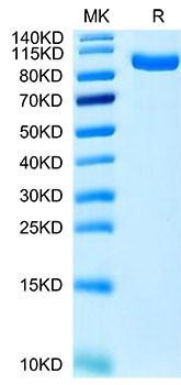 Recombinant Human PTK7/CCK4 Protein (RPCB1689)