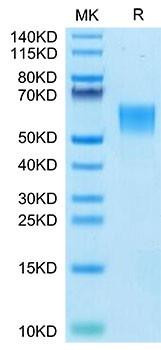 Recombinant Human ENPP-3(558-875) Protein (RPCB1756)