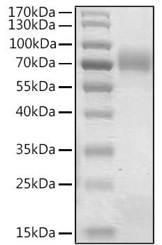 Recombinant Human Angiopoietin-like 8/ANGPTL8 (22-198) Protein (RPCB1762)
