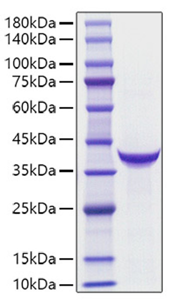 Recombinant Human PG IIï¼ˆPGCï¼‰ Protein (RPCB1766)