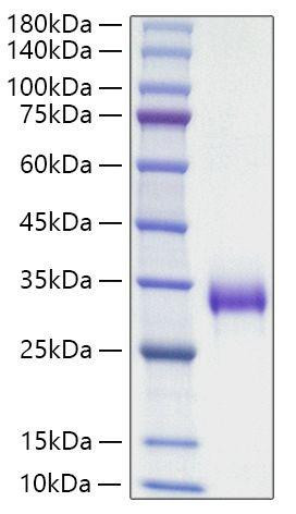 Recombinant Mouse TIMP-1 Protein (RPCB1871)