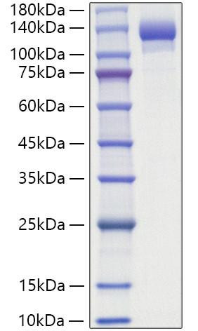 Recombinant Human ENPP-1 Protein (RPCB1885)