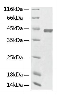 Recombinant Human Aminoacylase 1/ACY 1 Protein (RPCB1887)