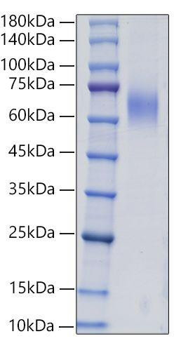 Recombinant Human Mucin-2 /MUC2 Protein (RPCB1919)