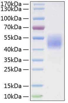 Recombinant Mouse Follistatin-like protein 1/FSTL1 Protein (RPCB1925)