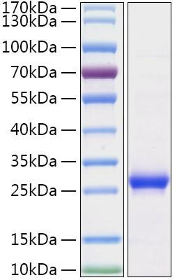 Recombinant Human Histone H1 Protein (RPCB1951)