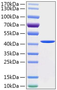 Recombinant Human Cathepsin E Protein (RPCB2019)