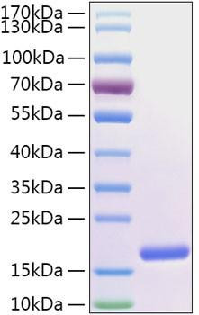 Recombinant Human FABP5/E-FABP Protein (RPCB2021)