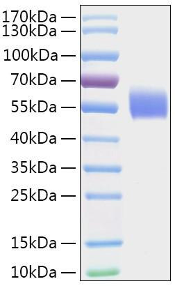 Recombinant Human Dihydropyrimidinase/DPYS Protein (RPCB2036)