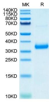 Recombinant SARS-COV-2 Spike RBD (N501Y,K417N,E484K) Protein (RPCB2051)
