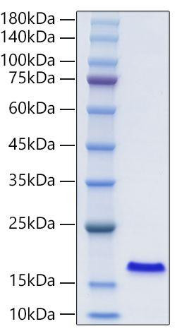 Recombinant Human FABP2/I-FABP Protein (RPCB2121)