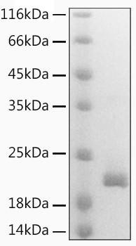 Recombinant Mouse Lymphotactin/XCL1 Protein (RPCB2126)