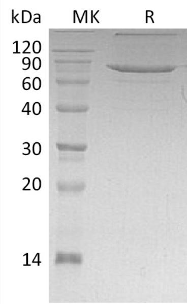 Recombinant Human XPNPEP1 Protein (RPCB2135)