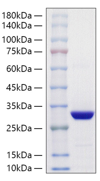 Recombinant Schistosoma japonicum GST-His Protein (RPCB2167)