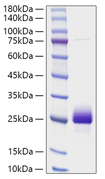 Recombinant Human NBL1 Protein (RPCB2186)