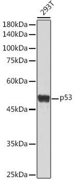 Anti-p53 Antibody (CAB0263)