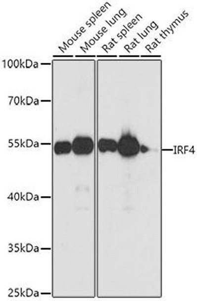 Anti-IRF4 Antibody (CAB0524)