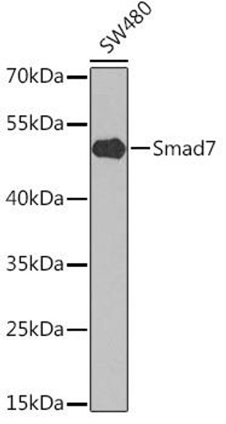Anti-Smad7 Antibody (CAB1051)