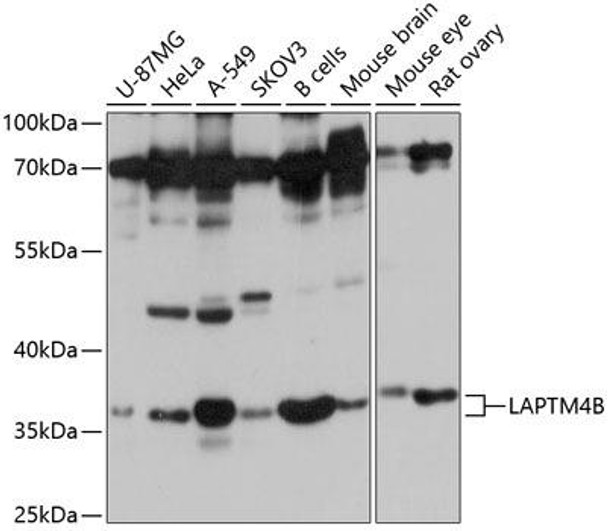 Anti-LAPTM4B Antibody (CAB10761)