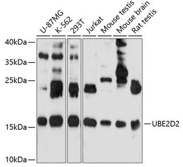 Anti-UBE2D2 Antibody (CAB10818)
