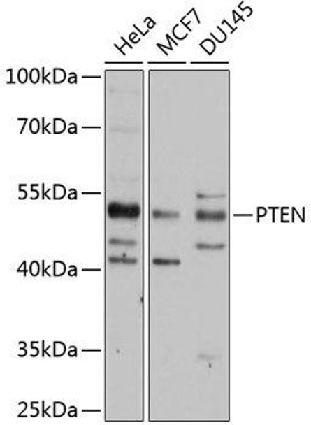Anti-PTEN Antibody (CAB11528)