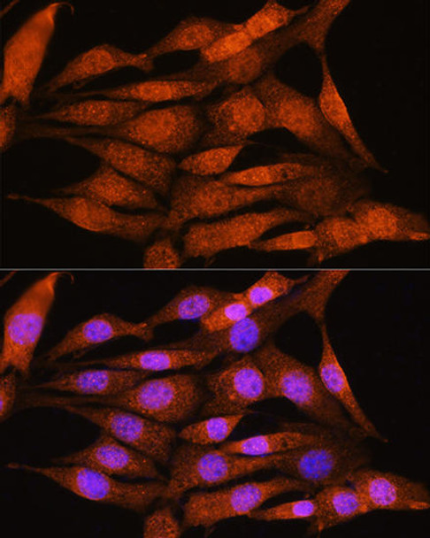 Anti-BCL3 Antibody (CAB11582)