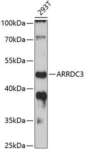 Anti-ARRDC3 Antibody (CAB12262)